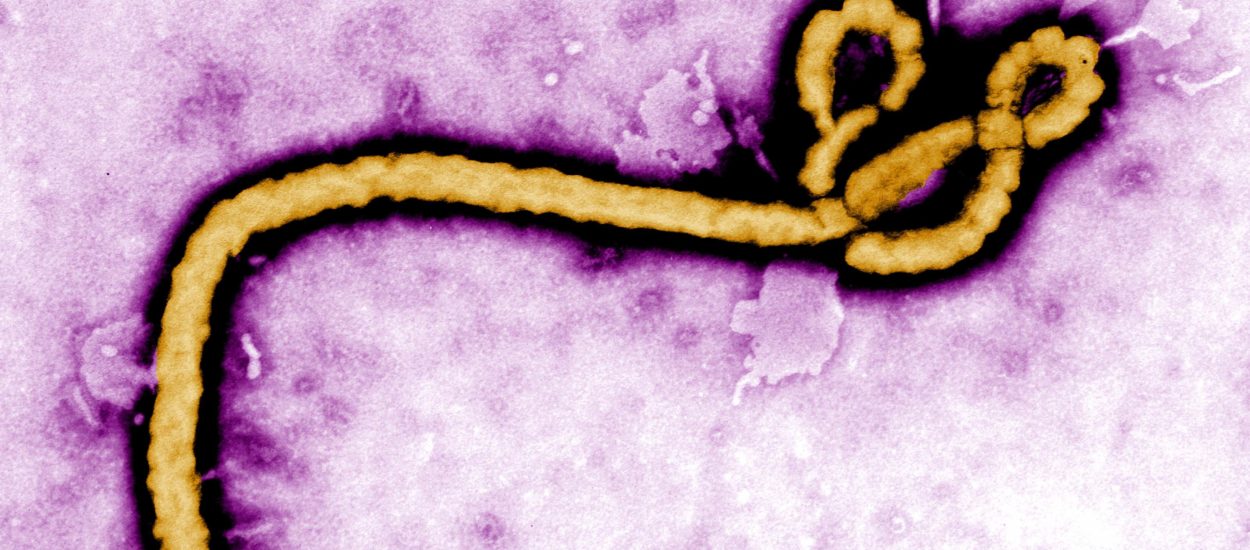 Ebola